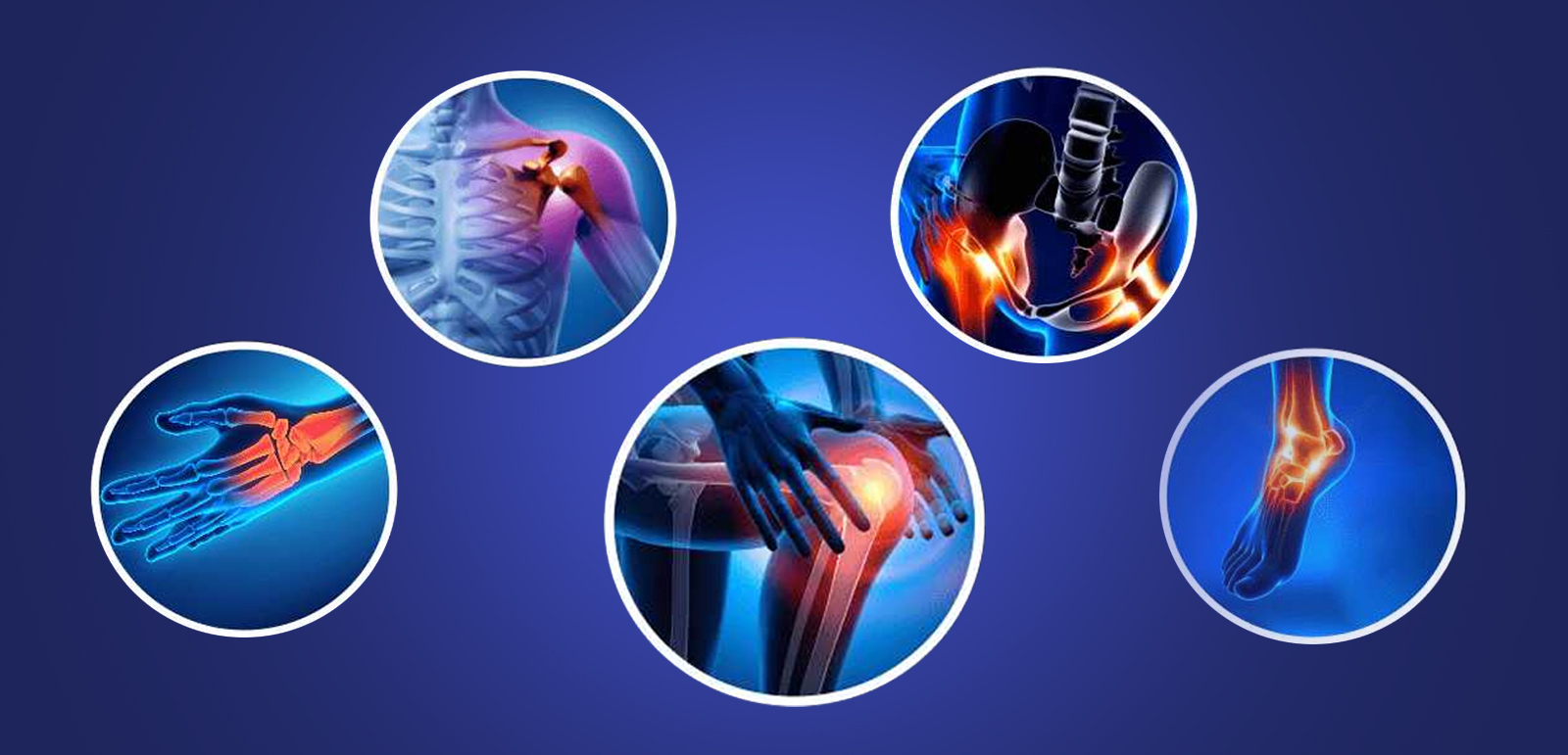 আর্থ্রাইটিস